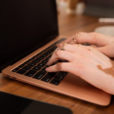 Hands with rings typing on laptop - 4480x6720